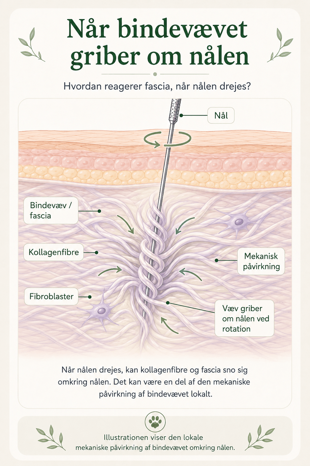Illustration af bindevæv og kollagenfibre der snor sig omkring en akupunkturnål, når nålen drejes i vævet