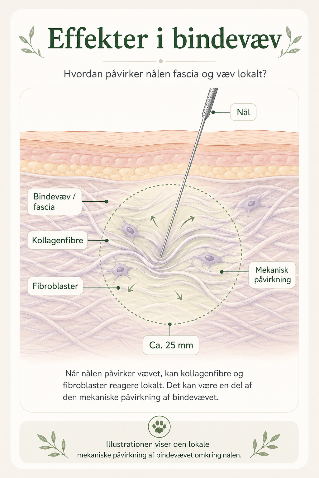 Illustration af akupunkturnål i bindevæv med kollagenfibre, fibroblaster og et lokalt påvirkningsområde på cirka 25 mm